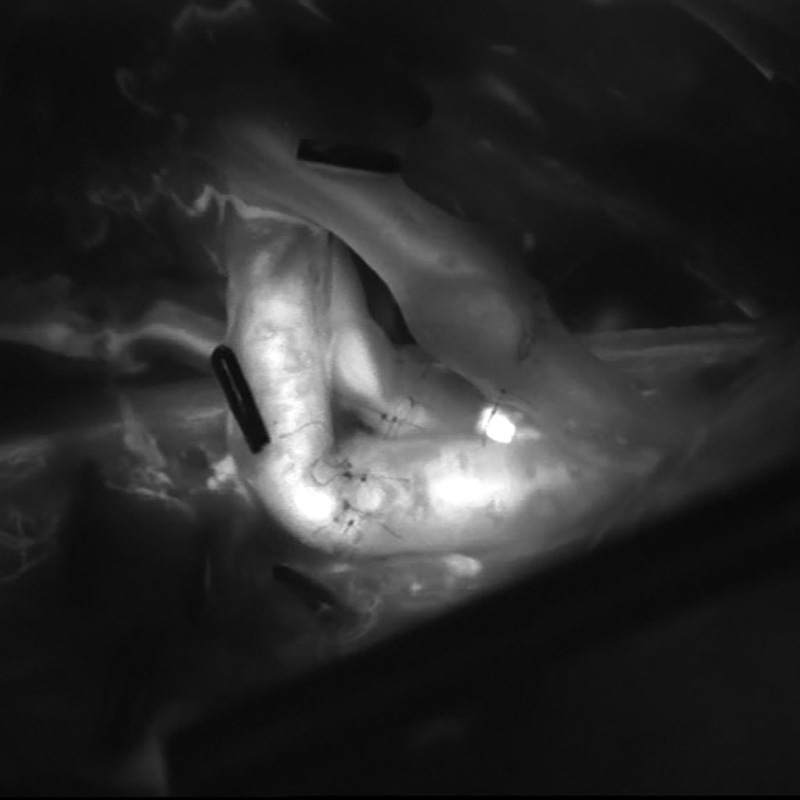 Современная система визуализации для нейрохирургии ZEISS TIVATO 700